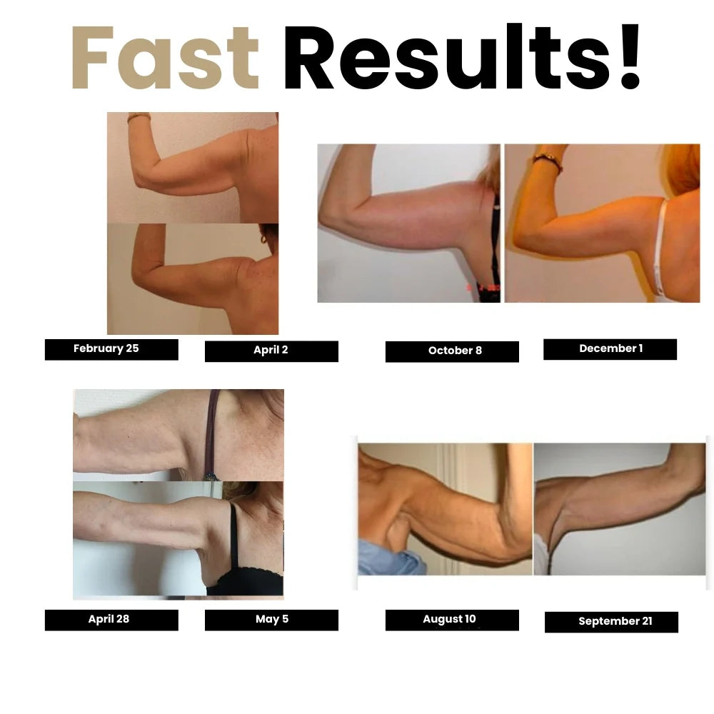 Aveli 3D Compression Sleeves